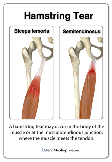 the hamstring muscle